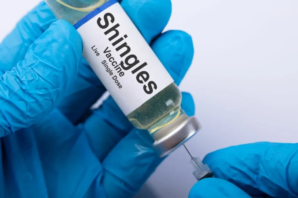 Shingles