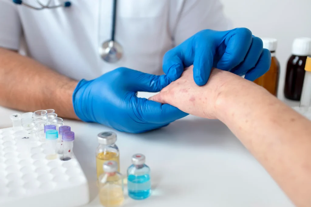 Chickenpox Vaccination at Chemitex Pharmacy